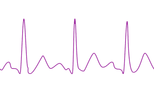 Nopea EKG